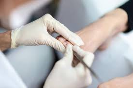 Soins de podologie pour adultes Sarcelles
