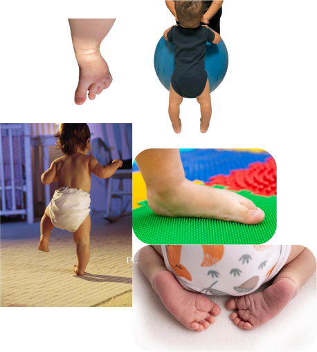Soins de podologie pour enfants Sarcelles